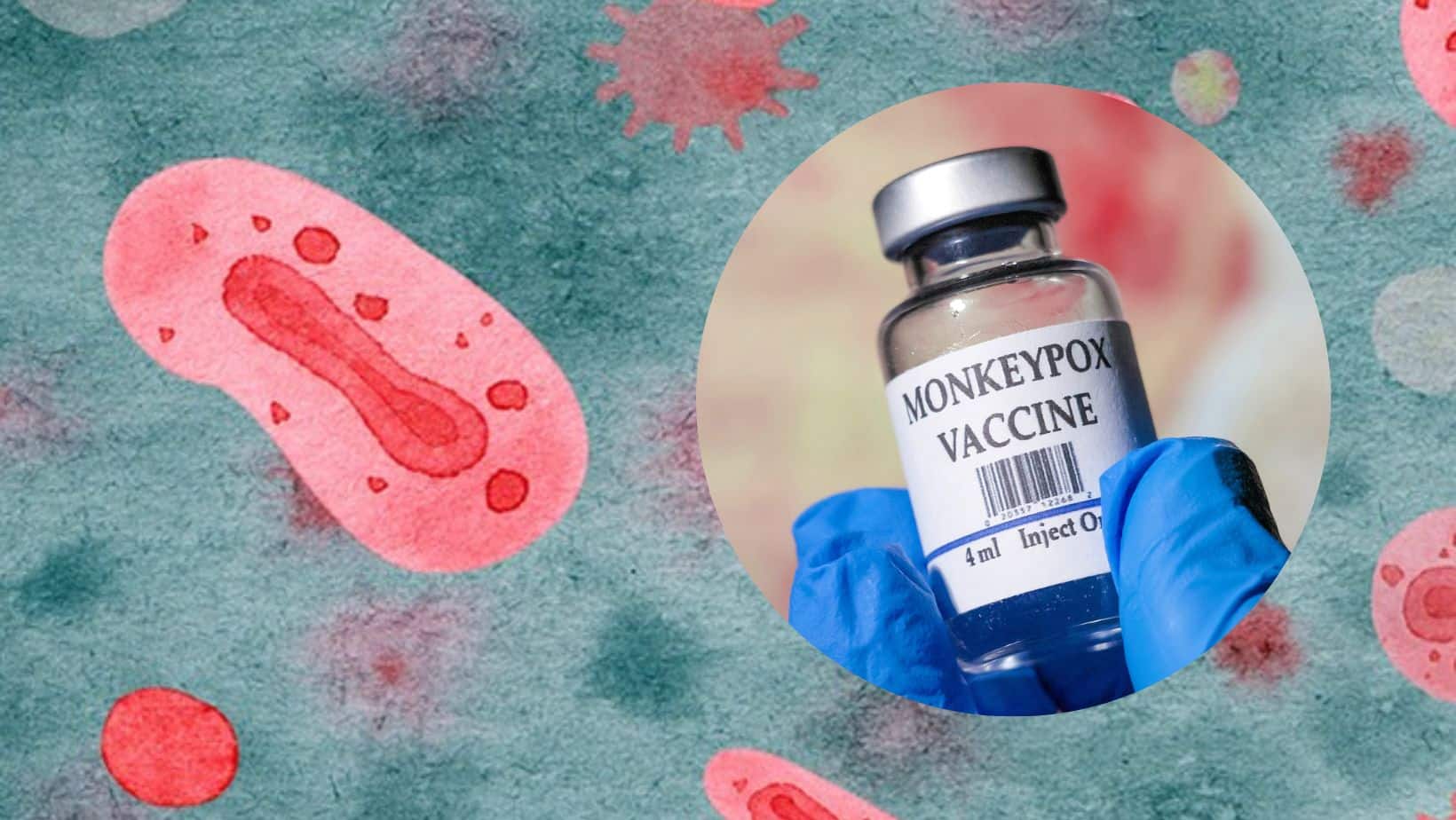 Monkeypox Vaccine Is Not 100% Effective, WHO Advices People To Continue Taking Precautions